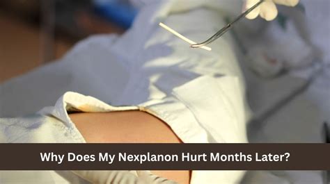 does nexplanon cause bloating